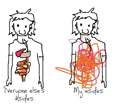 Introduction to fructose malabsorption: common traps and tips // Einführung Fructoseintoleranz: Alltagsfallen und Tipps // Fructopia.de